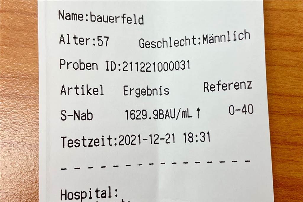 Mein Ergebnis: Sieht aus wie ein Kassenzettel, zeigt aber die Anzahl an Antikörpern im Blut.