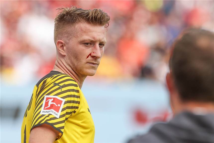 BVB-Kapitän Reus bleibt nach Beleidigungen cool - und sorgt sich um die Defenisve Mit blutender Nase zum Auswärtssieg: BVB-Kapitän Marco Reus.
