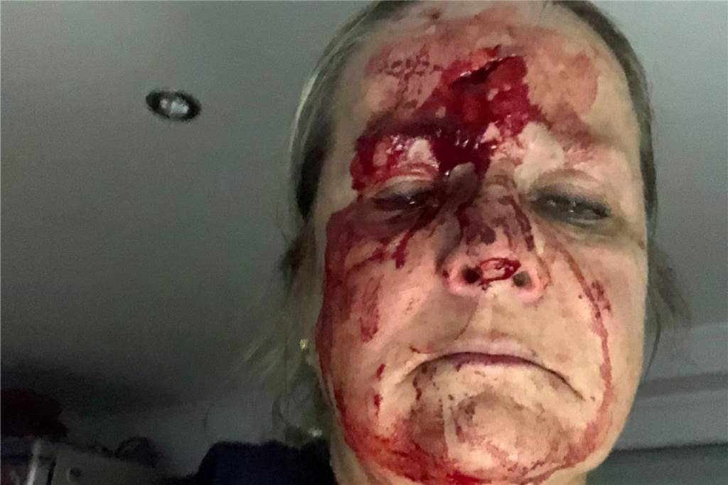 Dagmar S. mit blutiger Kopfverletzung.
