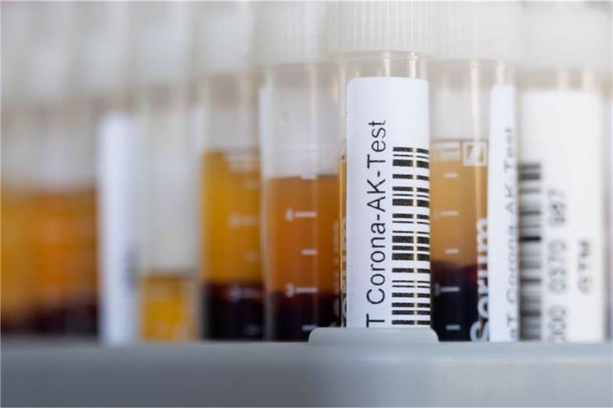 Ist ein Antikörpertest vor der Booster-Impfung sinnvoll? November 2021: Für einen Antikörpertest wird Blut abgenommen und analysiert.