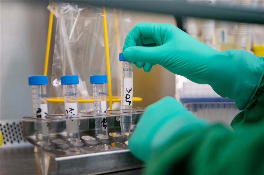 Coronavirus ist in NRW angekommen: Hier gibt es Antworten auf die wichtigsten Fragen Ob es sich um eine gewöhnliche Grippe oder um das Coronarvirus handelt, lässt sich nur im Labor feststellen.