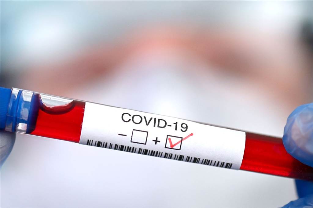 Wegen hoher Infektionszahlen: Kontaktermittler stoßen an Grenzen Oftmals bekommen mittels PCR-Test positiv getestete Personen über Apps, Labore oder Ärzte den Befund mittgeteilt, ehe der Kreis Kontakt aufgenommen hat.
