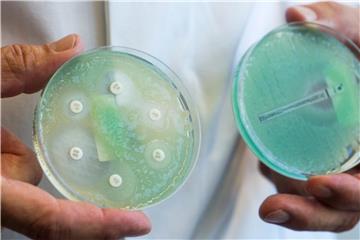 Petrischalen mit sogenannten Krankenhauskeimen, die Mehrfachresistenzen gegenüber Antibiotika aufweisen. Foto: Armin Weigel
