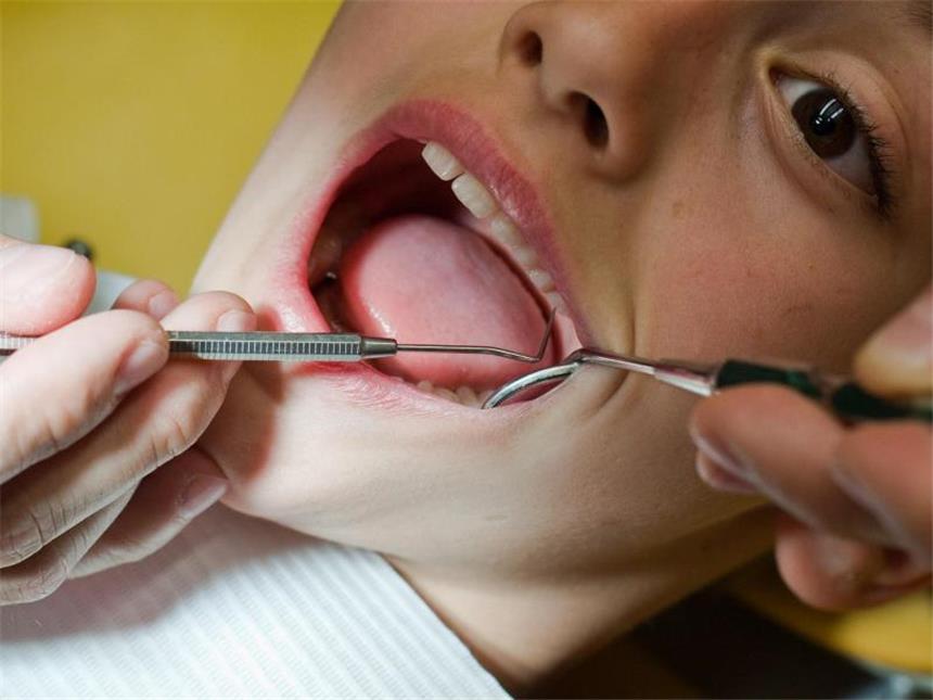 Krankenkassen: Selbstzahler-Leistungen bringen meist nichts Professionelle Zahnreinigung soll laut Studie medizinisch nicht notwendig sein. Foto: Patrick Pleul/Symbolbild