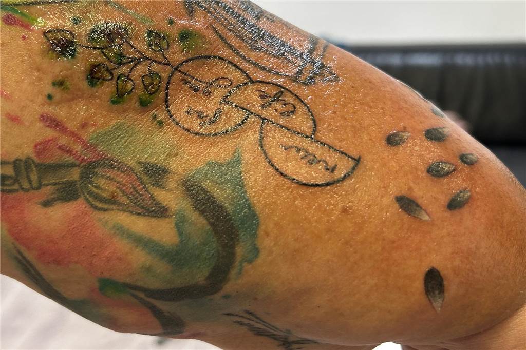 Dorstenerinnen lassen sich Organspende-Tattoo stechen Das Organspende-Tattoo zeigt einen Kreis mit zwei darunterliegenden Halbkreisen.
