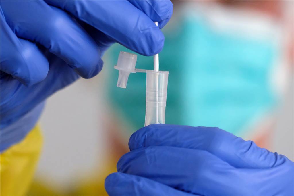 „Unsere Tests sind in den Top 20“ - Omikron in den Dorstener Teststellen Sind Antigen-Schnelltests auch bei der Omikron-Variante zuverlässig?
