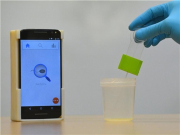 So geht's: Die Kamera des Smartphones analysiert die Spermienkonzentration und -beweglichkeit in der Probe. Foto: Vignesh Natarajan/Science Translational Medicine/dpa