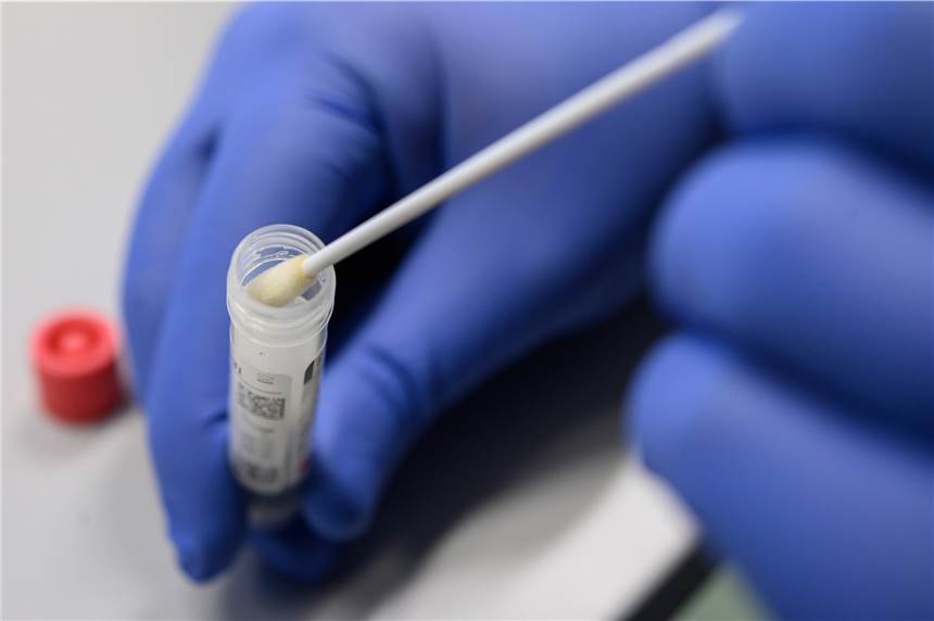 Zwei weitere Corona-Infektionen in Schwerte bestätigt - Rückkehrer aus Risikogebieten So sieht es aus, wenn ein Abstrich für das Testverfahren auf das Virus SARS-CoV-2. gesichert wird.