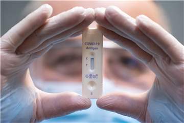 Sollten Sportvereine Schnelltests vornehmen dürfen? Das Ministerium für Arbeit, Gesundheit und Soziales sagt nein.