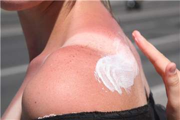 Sonnencreme beugt Hautkrebs vor. „Ein Irrglaube“, warnt der Tübinger Hautkrebsexperte Garbe. Die Haut könne durch Sonnenschutzmittel nicht komplett vor Hautkrebs geschützt werden. Foto: Stephanie Pilick