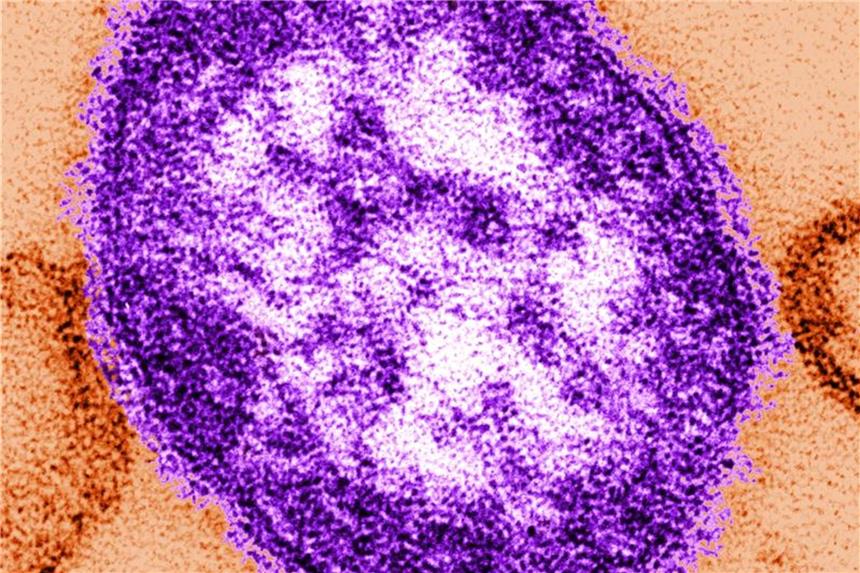 Masern bedrohen Indigenen-Stamm im Amazonasgebiet Teile eines Masernvirus, das mit Hilfe eines Transmissionselektronenmikroskops aufgenommen wurde. Die Krankheit bedroht einen indigenen Stamm an der Grenze zwischen Venezuela und Brasilien. Foto: Cynthia Goldsmith/Archiv