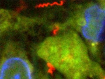 Treponema pallidum, der Erreger der Syphilis - die Geschlechtskrankheiten Syphilis, Gonorrhoe und Chlamydiose sind wegen Antibiotikaresistenzen immer schwerer zu bekämpfen. Foto: PD Dr. Annette Moter/Charite-Universitätsmedizin Berlin