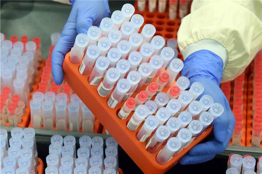 Corona-Infektionen: Zahl in Dortmund am Montag fast bei Null Viele PCR-Tests. aber kaum noch positive – das ist das Bild in den Laboren.