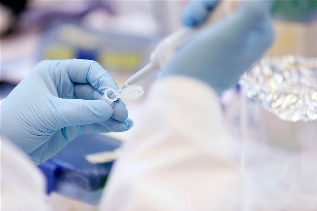 Neue Impf-Technologie aus Dortmund soll ohne Nadel vor Coronavirus schützen Welcher Wirkstoff Covid 19 am besten bekämpft, ist noch völlig offen. Die Technologie des Forscher-Teams aus Dortmund und Potsdam kann mehrere Wirkstoffe transportieren.