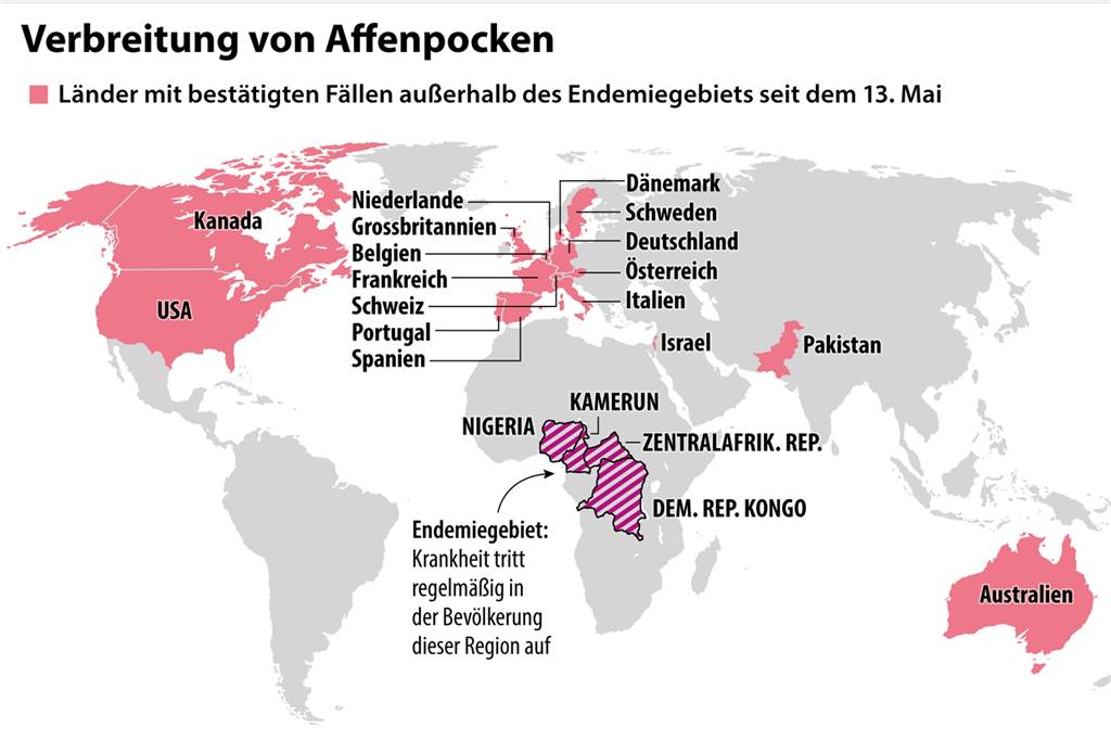 Sind die Affenpocken noch ein Problem? Acht Fragen zur aktuellen Situation Weltkarte mit bislang bestätigten Fällen von Affenpocken