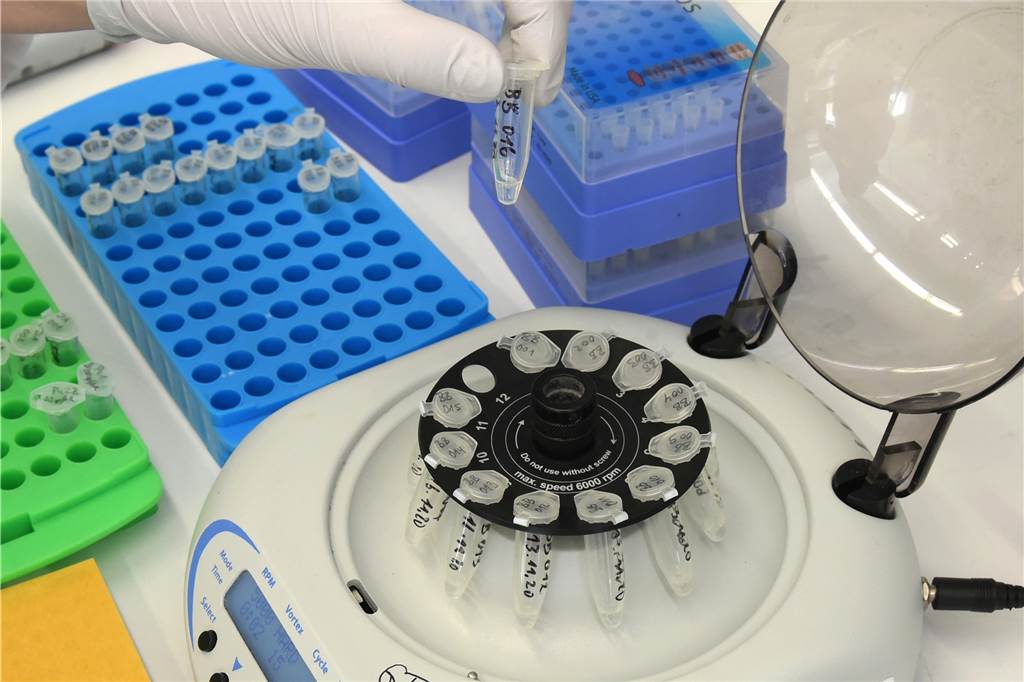 Über 18.000 Omikron-Fälle: Kreis Borken ist NRW-Spitzenreiter Wie der Kreis Borken mitteilt, treffen die Ergebnisse der PCR-Tests aus den Laboren zeitnah nach dem Einreichen ein. So können die Ergebnisse auch zügig an das LZG weitergegeben werden.