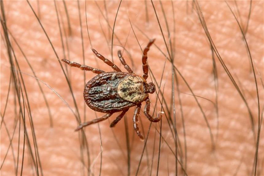 Mit milden Temperaturen startet die Zeckensaison Zecken krabbeln zunächst auf dem Körper umher, um eine geeignete Stelle zu finden. Wer sich in der Natur aufgehalten hat, sollte seinen Körper daher sofort auf Zecken kontrollieren. Foto: Patrick Pleul
