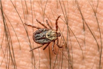 Zecken krabbeln zunächst auf dem Körper umher, um eine geeignete Stelle zu finden. Wer sich in der Natur aufgehalten hat, sollte seinen Körper daher sofort auf Zecken kontrollieren. Foto: Patrick Pleul